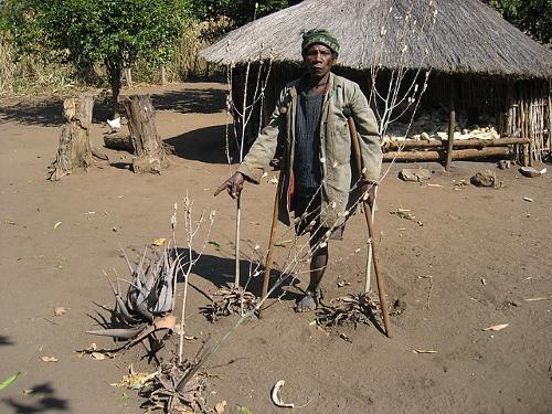 Landmine Victim, Angola