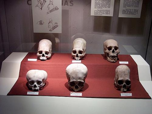 Skulls of the Paracas culture from the Andes. They illustrate the flattening of the head, as was common among the elite of this culture